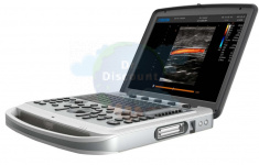 УЗИ аппарат CHISON SonoBook 6